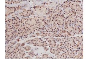 ABIN6269133 at 1/200 staining Human pancreas tissue sections by IHC-P. (KIT Antikörper  (Internal Region))