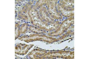 Immunohistochemistry of paraffin-embedded rat kidney using PDCD6IP antibody. (ALIX Antikörper  (AA 1-180))