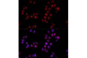 Immunofluorescence analysis of HeLa cells using HMGB1 antibody (ABIN5971378) at dilution of 1/100 (40x lens).