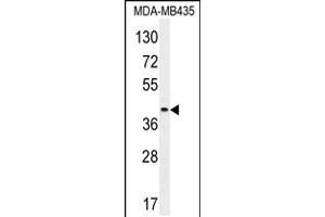 Western blot analysis in MDA-MB435 cell line lysates (35ug/lane). (LILRA5 Antikörper  (N-Term))