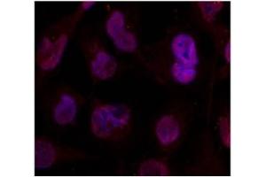 Image no. 1 for anti-Histone Deacetylase 4 (HDAC4) (Ser632) antibody (ABIN197338)