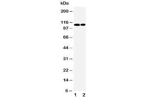 Western blot testing of p107 antibody and Lane 1:  239T (p107 Antikörper  (C-Term))