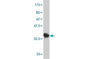 Western Blot detection against Immunogen (38. (ZAK Antikörper  (AA 1-120))