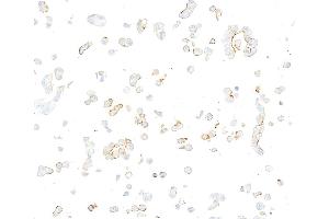 anti-Nectin cell adhesion molecule 3 (NECTIN3) (AA 58-400) antibody