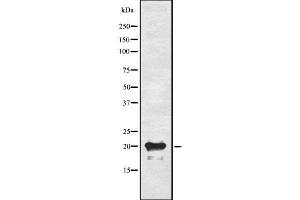 Western blot analysis of ADM using A549 whole cell lysates (Adrenomedullin Antikörper  (N-Term))