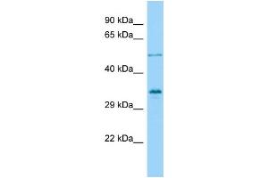Host: Rabbit Target Name: VGLL4 Sample Type: OVCAR-3 Whole Cell lysates Antibody Dilution: 1. (VGLL4 Antikörper  (Middle Region))
