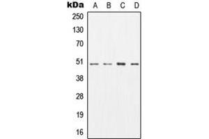 Western blot analysis of AP2M1 expression in SKBR3 (A), MCF7 (B), mouse brain (C), rat brain (D) whole cell lysates.