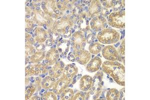 Immunohistochemistry (Paraffin-embedded Sections) (IHC (p)) image for anti-Proteasome (Prosome, Macropain) 26S Subunit, Non-ATPase, 9 (PSMD9) (AA 1-223) antibody (ABIN6146349)