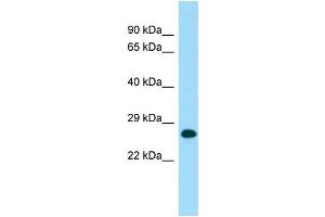 WB Suggested Anti-MOB1A Antibody Titration: 1. (MOB1A Antikörper  (C-Term))
