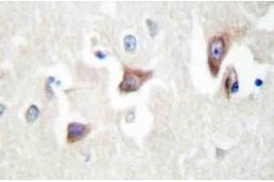 Immunohistochemistry (IHC) analyzes of MRCKbeta antibody in paraffin-embedded human brain tissue. (CDC42BPB Antikörper)