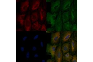 ABIN6257095 and ABIN6275980 staining  cells by IF/ICC.
