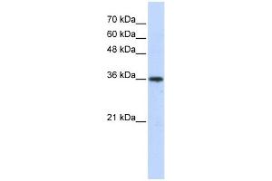 AKR7A3 antibody used at 1 ug/ml to detect target protein. (AKR7A3 Antikörper)