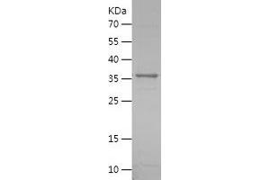Western Blotting (WB) image for beta-1,3-Glucuronyltransferase 1 (Glucuronosyltransferase P) (B3GAT1) (AA 35-334) protein (His tag) (ABIN7121996) (CD57 Protein (AA 35-334) (His tag))