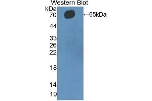 Detection of Recombinant CD5, Human using Polyclonal Antibody to Cluster Of Differentiation 5 (CD5) (CD5 Antikörper  (AA 25-372))