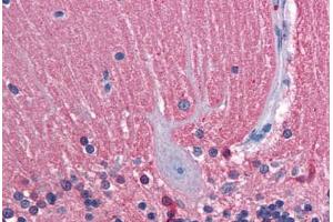 Human Brain, Cerebellum: Formalin-Fixed, Paraffin-Embedded (FFPE) (TUBB2A Antikörper  (AA 1-446))