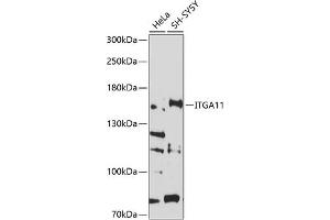 Western blot analysis of extracts of various cell lines, using ITG antibody (ABIN6132866, ABIN6142556, ABIN6142557 and ABIN6214212) at 1:1000 dilution. (ITGA11 Antikörper  (AA 940-1141))
