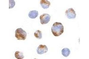 Immunocytochemistry of BMI-1 in K562 cells with AP30158PU-N BMI-1 antibody at 10 μg/ml. (BMI1 Antikörper  (Intermediate Domain))