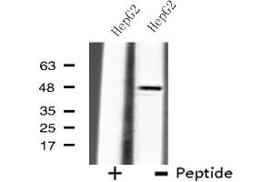 Western blot analysis of extracts from HepG2 cells using B4GALT3 antibody. (B4GALT3 Antikörper  (Internal Region))