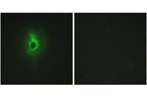 Immunofluorescence analysis of HeLa cells, using Collagen VI alpha3 Antibody. (COL6a3 Antikörper  (AA 2261-2310))