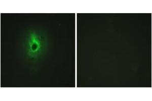 Immunofluorescence analysis of HeLa cells, using Collagen VI alpha3 Antibody.