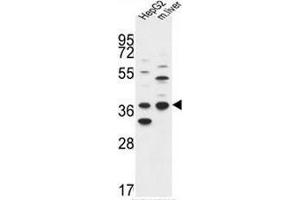 DHRS3 Antibody (Center) western blot analysis in HepG2 cell line and mouse liver tissue lysates (35µg/lane). (DHRS3 Antikörper  (Middle Region))