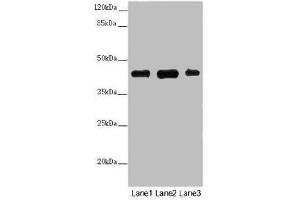 Western blot All lanes: SS18L1 antibody at 2 μg/mL Lane 1: Mouse kidney tissue Lane 2: Mouse lung tissue Lane 3: Mouse spleen tissue Secondary Goat polyclonal to rabbit IgG at 1/10000 dilution Predicted band size: 43, 41, 34, 30, 44 kDa Observed band size: 43 kDa (SS18L1 Antikörper  (AA 47-396))
