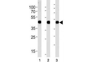 Alpha Actin antibody western blot analysis in (1) A549, (2) RD, and (3) human placenta lysate (Actin Antikörper  (AA 346-375))