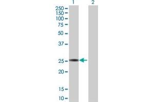 Western Blot analysis of GSTA3 expression in transfected 293T cell line by GSTA3 MaxPab polyclonal antibody. (GSTA3 Antikörper  (AA 1-222))
