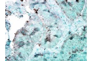 Immunohistochemistry analysis using Mouse Anti-Hsp90 Monoclonal Antibody, Clone 4F3. (HSP90 Antikörper)