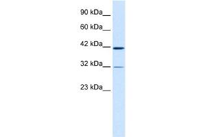 WB Suggested Anti-CHST4 Antibody Titration:  0.