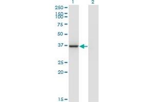Western Blot analysis of LZTFL1 expression in transfected 293T cell line by LZTFL1 monoclonal antibody (M09), clone 1B1.