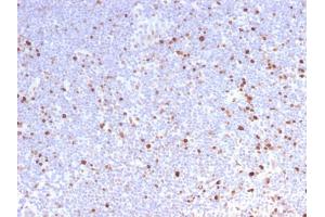 Formalin-fixed, paraffin-embedded human Lymph Node stained with MCM7 Rabbit Recombinant Monoclonal Antibody (MCM7/2832R). (Rekombinanter MCM7 Antikörper  (AA 195-319))