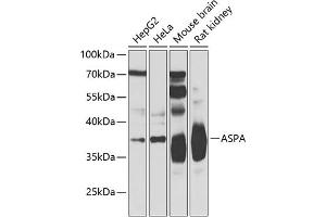 Western blot analysis of extracts of various cell lines, using ASPA Antibody (ABIN6127373, ABIN6137211, ABIN6137212 and ABIN6223094) at 1:500 dilution. (ASPA Antikörper  (AA 1-313))