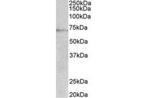 AP31950PU-N DBH antibody staining of Jurkat lysate at 2 µg/ml (35µg protein in RIPA buffer). (DBH Antikörper  (Internal Region))