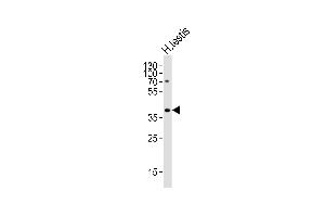 Western blot analysis of lysate from human testis tissue lysate, using TSPY2 Antibody (Center) (ABIN6244122 and ABIN6577495).