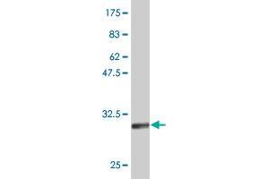 Western Blot detection against Immunogen (31. (ATOH7 Antikörper  (AA 53-99))