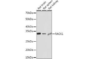 Western blot analysis of extracts of various cell lines, using R Rabbit mAb (ABIN1679360, ABIN3018118, ABIN3018119 and ABIN7101576) at 1:1000 dilution.