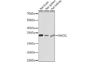 Western blot analysis of extracts of various cell lines, using R Rabbit mAb (ABIN1679360, ABIN3018118, ABIN3018119 and ABIN7101576) at 1:1000 dilution. (GNB2L1 Antikörper)