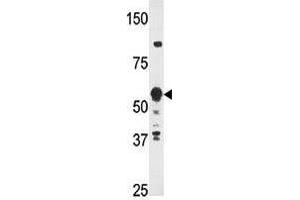 Image no. 1 for anti-Zinc Finger Protein 395 (ZNF395) (Center) antibody (ABIN357344) (ZNF395 Antikörper  (Center))