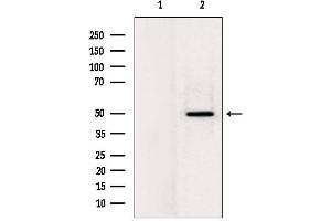Western blot analysis of extracts from rat heart, using LPCAT2 Antibody. (LPCAT2 Antikörper  (N-Term))