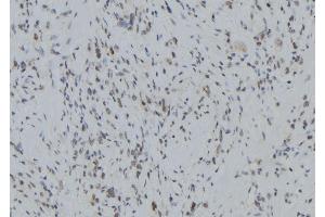 ABIN6279400 at 1/100 staining Human gastric tissue by IHC-P.