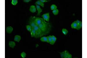 Immunofluorescence staining of MCF-7 cells with ABIN7149870 at 1:133, counter-stained with DAPI. (SAT2 Antikörper  (AA 1-170))