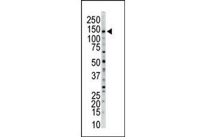 Image no. 1 for anti-Myosin Light Chain Kinase (MYLK) (N-Term) antibody (ABIN360383) (MYLK Antikörper  (N-Term))