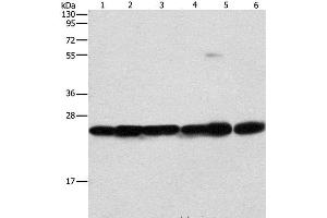 Western Blot analysis of Mouse liver and brain tissue, 293T, A549, A431 and PC3 cell using SIGMAR1 Polyclonal Antibody at dilution of 1:310 (SIGMAR1 Antikörper)