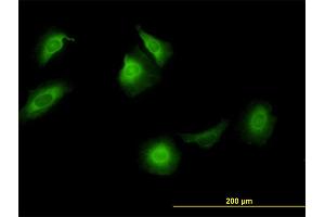 Immunofluorescence of monoclonal antibody to CCT5 on HeLa cell. (CCT5 Antikörper  (AA 1-541))