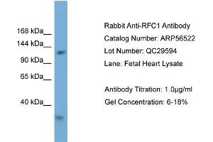 WB Suggested Anti-RFC1  Antibody Titration: 0.