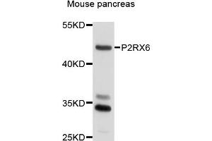 Western blot analysis of extracts of mouse pancreas cells, using P2RX6 antibody. (P2RX6 Antikörper)