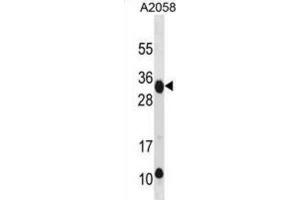 Western Blotting (WB) image for anti-Retinoic Acid Early Transcript 1E (RAET1E) antibody (ABIN3001003)