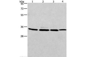 Western Blot analysis of A549, 231, PC3 and hela cell using MAD2L1BP Polyclonal Antibody at dilution of 1:675 (MAD2L1BP Antikörper)