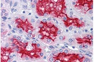 Human Kidney: Formalin-Fixed, Paraffin-Embedded (FFPE)